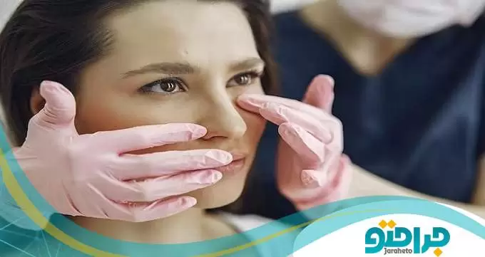 بینی های گوشتی چنددرصد احتمال بازگشت دارند؟