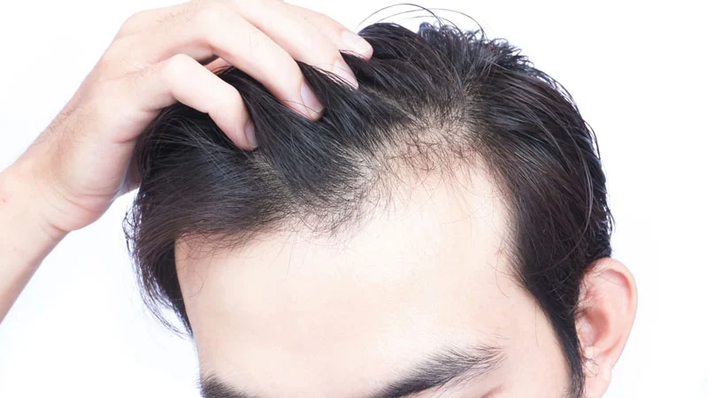 What-is-the-mechanism-of-action-of-anti-hair-loss-shampoos