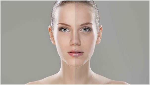 What is hifu face and how long does it last?