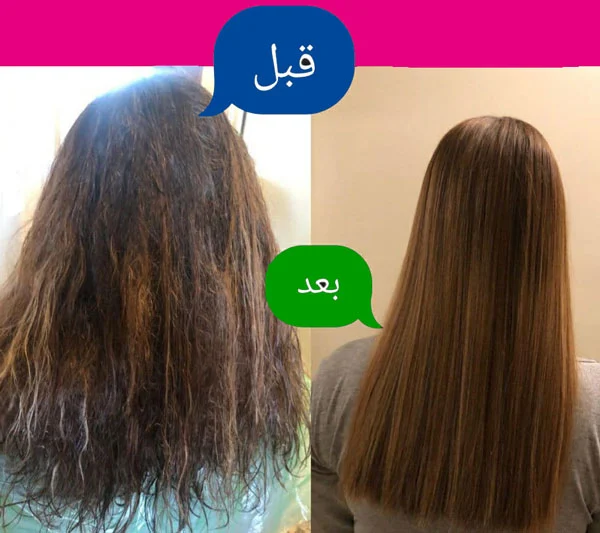 ویتامین