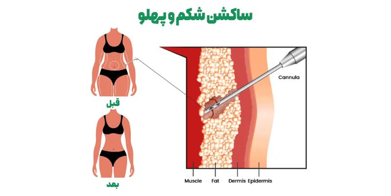 جراحی | رژیم غذایی